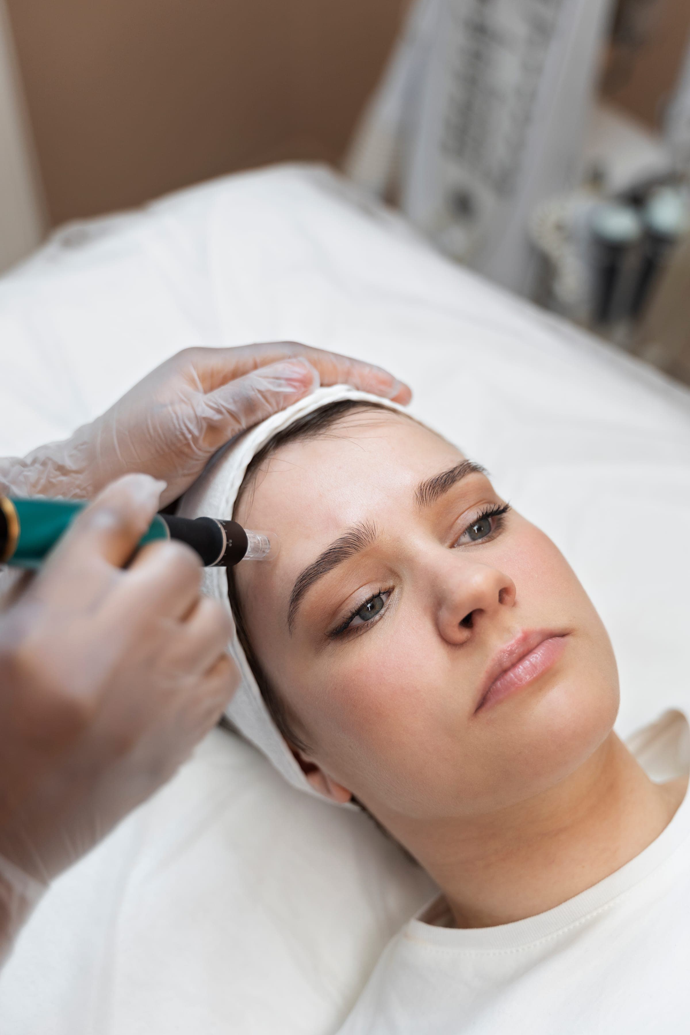 Microneedling facial treatment